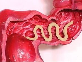 Parasiten im menschlichen Körper, warum sie erscheinen