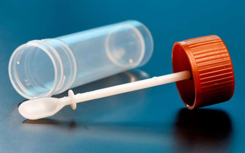 Stuhltest auf Würmer