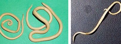 Welche Parasiten kann ein Mensch haben